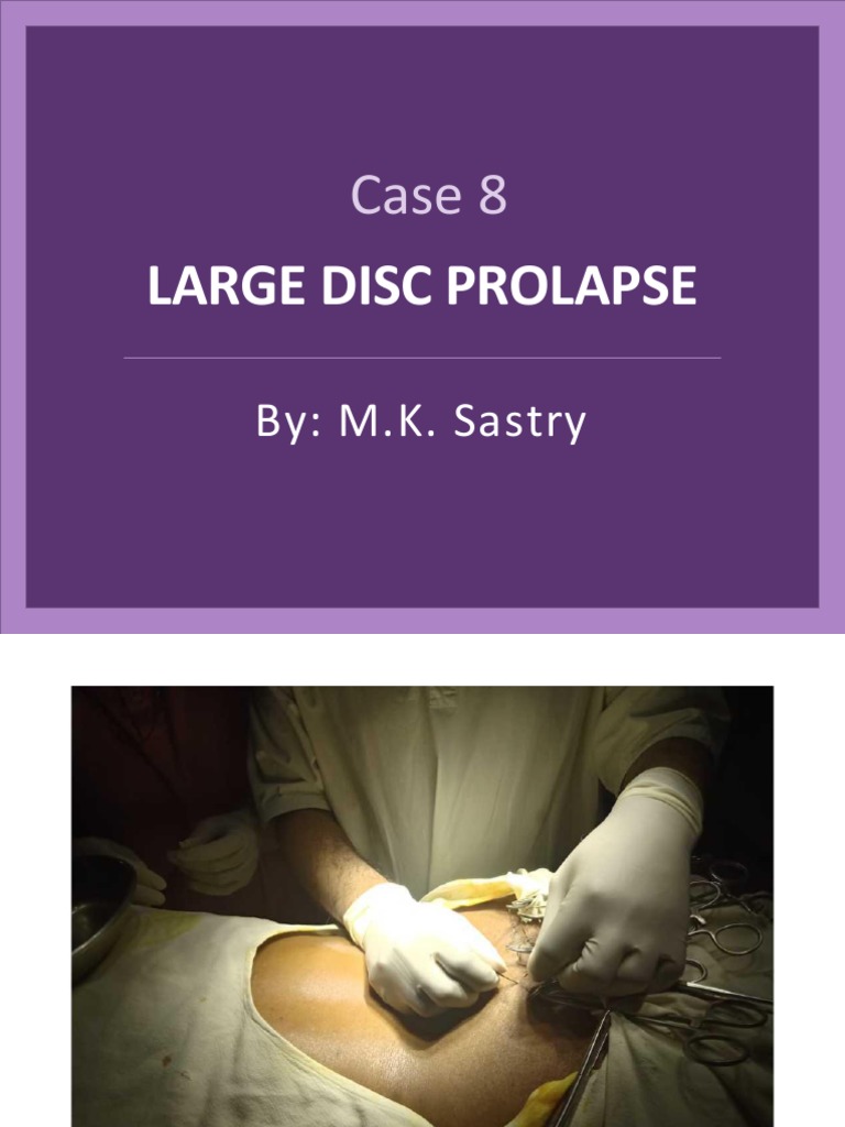 Large Disc Prolapse - Case 8 | PDF | Young Adult