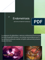 Endometriosis Adenomiosis