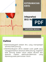 Intepretasi EKG Normal