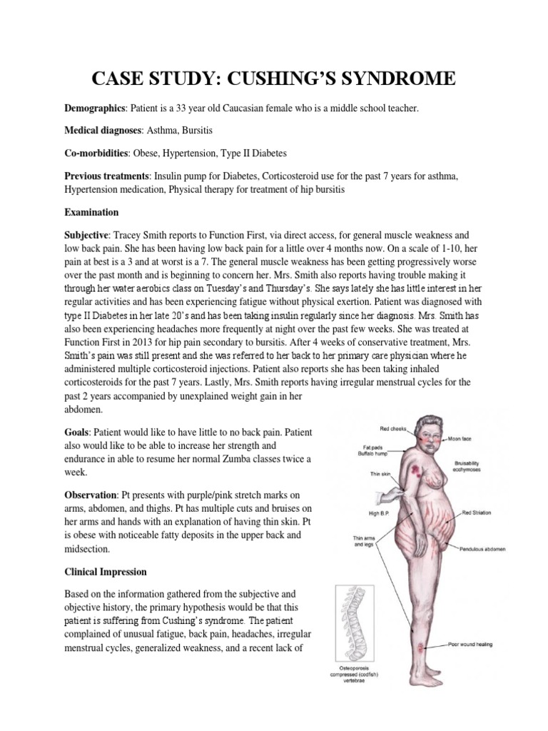 Case Study Cushing and Addison PDF Weakness Physical Therapy
