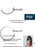 Torticollis: M. Amsyar Akil, Bagian THT-KL Universitas Hasanuddin