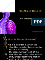 Frozen Shoulder: By: Denise Dela Cruz