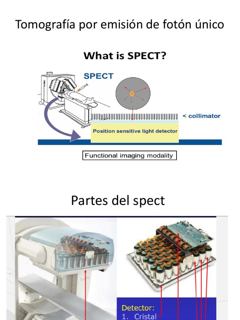 Presentacion Spect | PDF