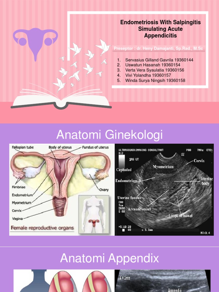 Endometriosis With Salpingitis Simulating Acute Appendicitis | PDF ...