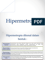 Hipermetropia