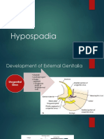 Hypospadia External Genitalia Development