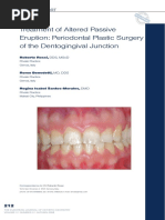 Treatment of Altered Passive Eruption Pe PDF