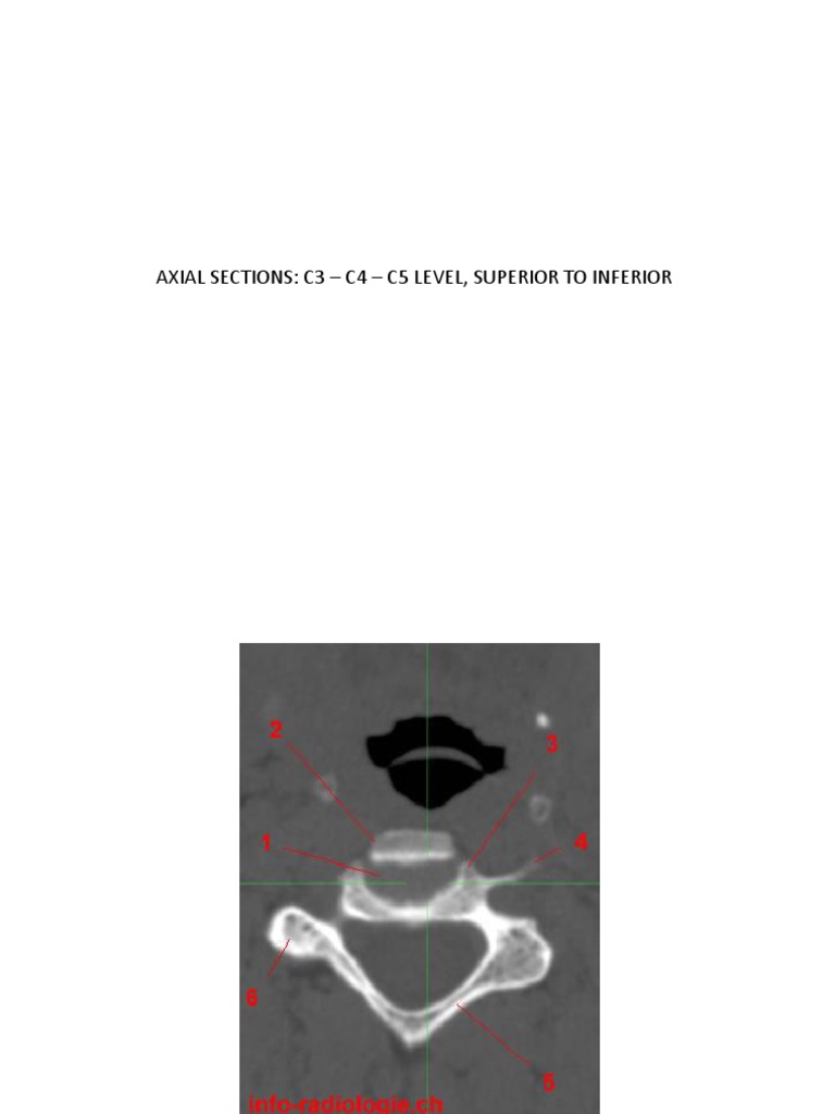 Axial Sections: C3 - C4 - C5 Level, Superior To Inferior | PDF