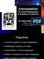 Chest radiography.ppt