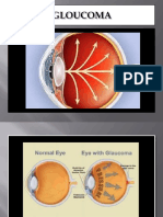KMB III (Pak Supriyadi) - GANGGUAN GLUKOMA