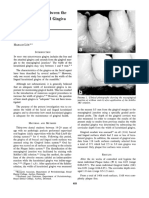 Lang and Loe (1972) - The Relationship Between The Width of Keratinized Gingiva and Gingival Health PDF