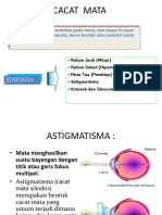 Lo Presbiopi Dan Astigmatisma