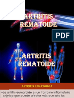 Artritis      rematoide.pptx