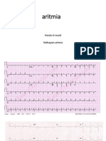 aritmia dokter muda.pptx