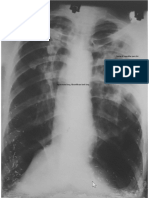 Radiologi Thorax MSK CT Scan