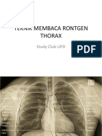 X Ray Thorax