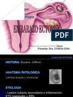 Embarazo Ectópico