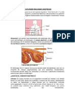 Neoplasias Malignas Gastricas