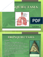 BRONQUIECTASIA2