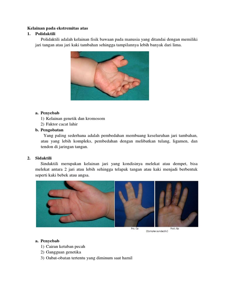 Kelainan Pada Ekstremitas Atas Pdf