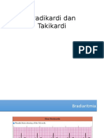 Bradikardi Dan Takikardi