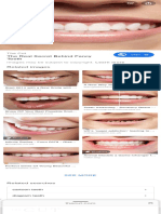 Teeth - Google Search