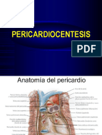 PERICARDIOCENTESIS