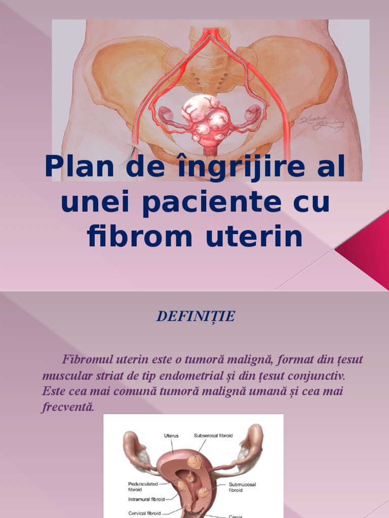 Fibrom Uterin | PDF