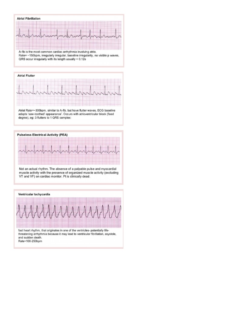 Af VT VF SVT | PDF