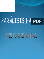 Paralisis Facial