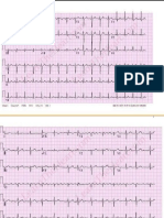 SOAL EKG