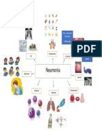 Neumonía: causas, síntomas y tratamiento