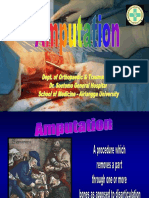 Amputation Optek Prof.dr