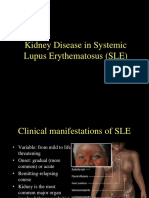 Kidney Disease in Systemic Lupus Erythematosus (SLE)