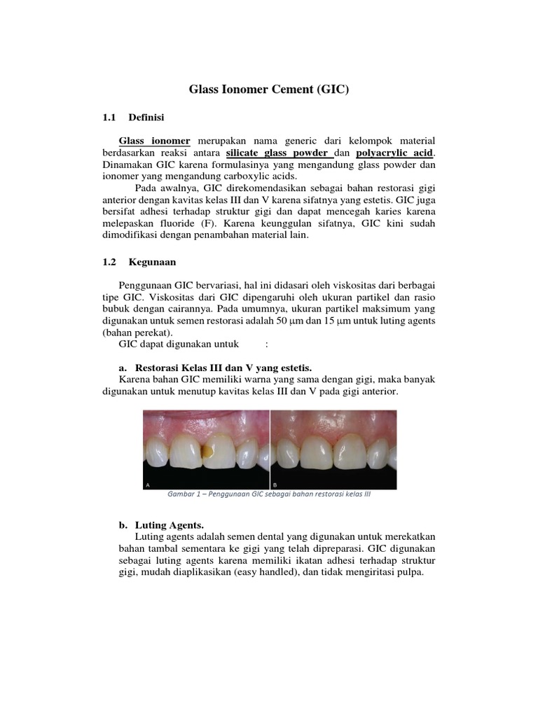 Definisi Dan Kegunaan Glass Ionomer Cement PDF