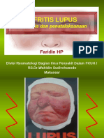 02 Lupus Nefritis Newediting