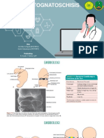 Labioplasty