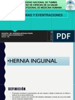 Hernias Inguinales Grupo 4