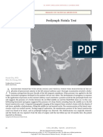 Perilymph Fistula Test: Images in Clinical Medicine