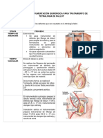 Proceso de Instrumentación Quirúrgica para Tratamiento de Tetralogía de Fallot