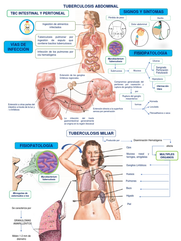 Fisiopatología de la tuberculosis abdominal | PDF | Tuberculosis | Rtt