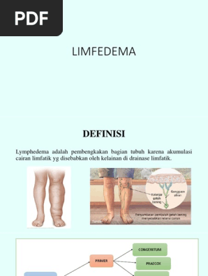 Limfedema Cs Pdf