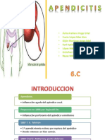 Apendicitis