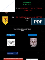 Traumatismos faciales medio tercio: Fracturas NOE y maxilares
