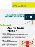 Kanker Vagina: Mahasiswa D4 Keperawatan Politeknik Kesehatan Malang