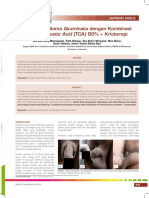 Terapi Kondiloma Akuminata Dengan Kombinasi Trichloroacetic Acid-TCA 80+krioterapi