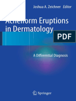Shinjita Das M.D., Rachel Reynolds M.D. (Auth.), Joshua Zeichner (Eds.) - Acneiform Eruptions in Dermatology - A Differential Diagnosis-Springer-Verlag New York (2014) PDF