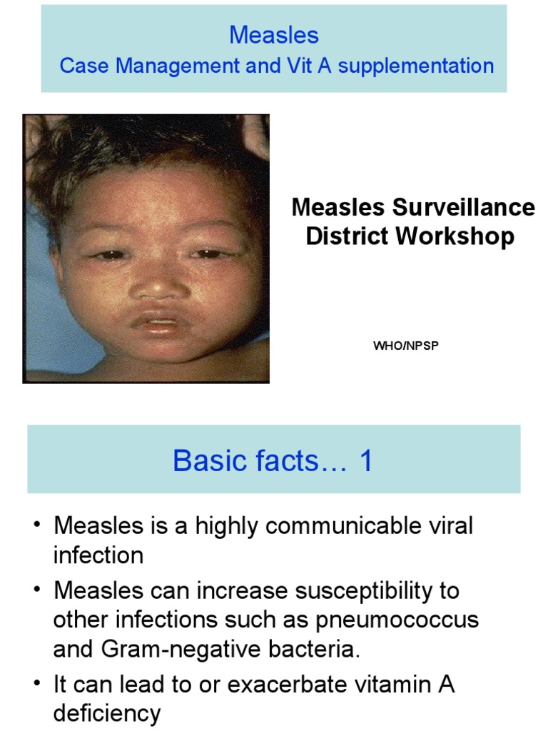 Measles Case Management & Vitamin A Guide | PDF | Measles | Vitamin A