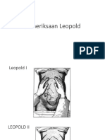 Pemeriksaan Leopold