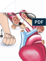 Hipertension Arterial